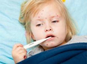 Three measles cases at Melbourne school