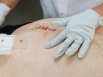 Surgical Wounds � Part 3